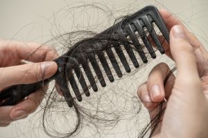 Hair Loss Treatment Near Me