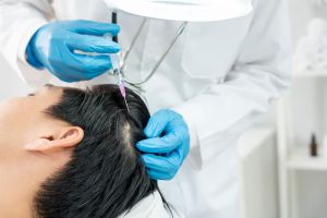 Hair Loss Treatment