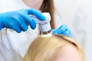 Hair Loss Treatments