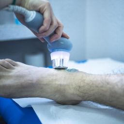 Shockwave Therapy for pain Treatment